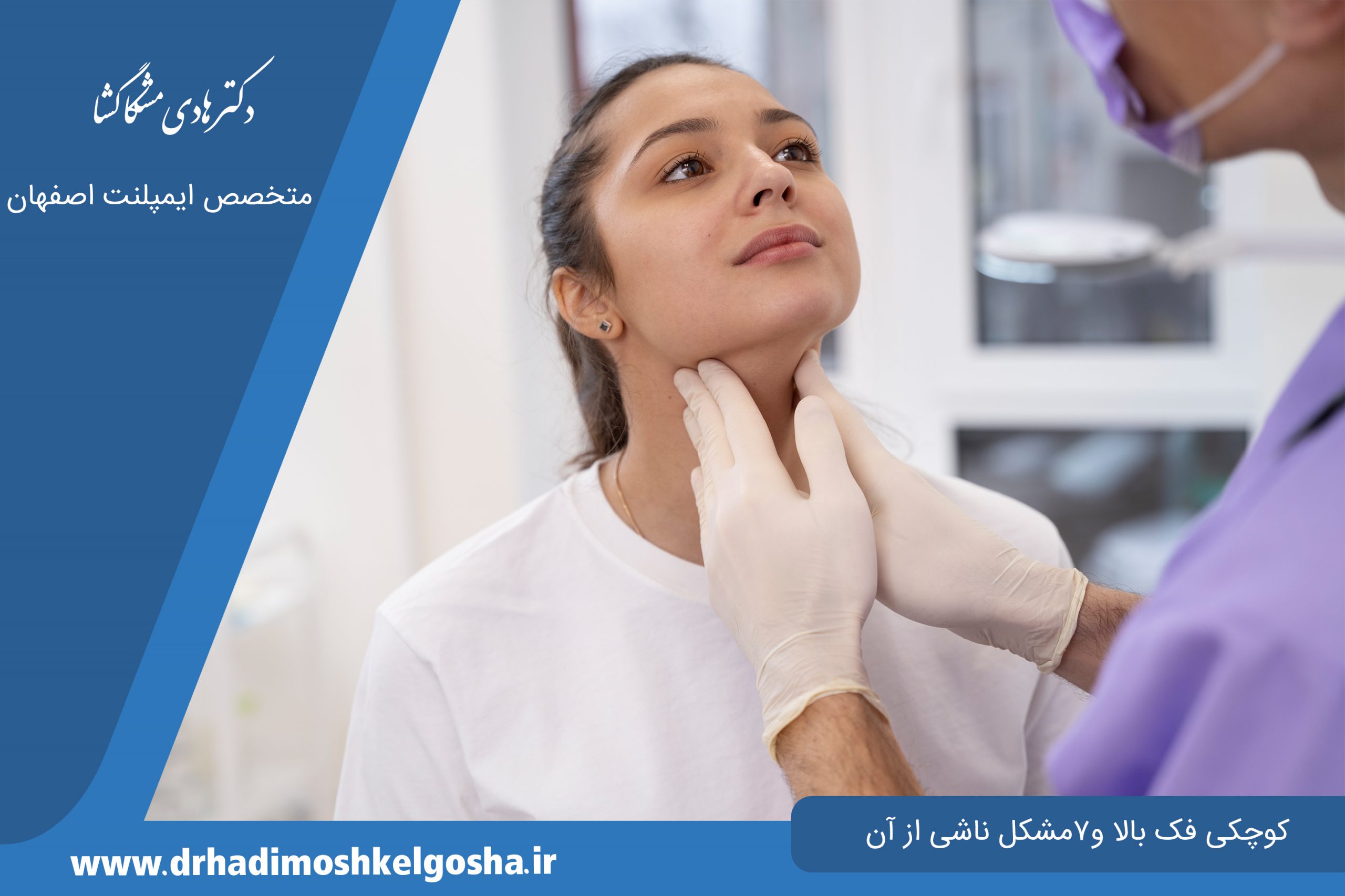 کوچکی فک بالا