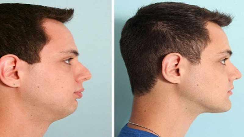 جراح دهان، فک و صورت اصفهان جراحی اصلاحی صورت (جراحی ارتوگناتیک)