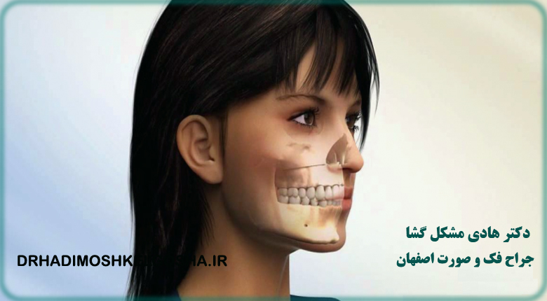 جراحی فک و صورت در اصفهان