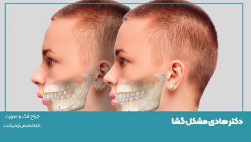 جراحی عفونت‌های فک و صورت در اصفهان
