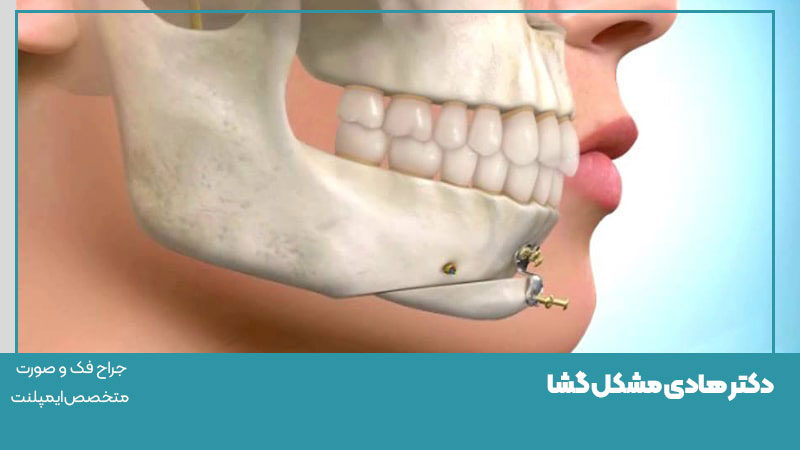جراحی‌های فک و دندان