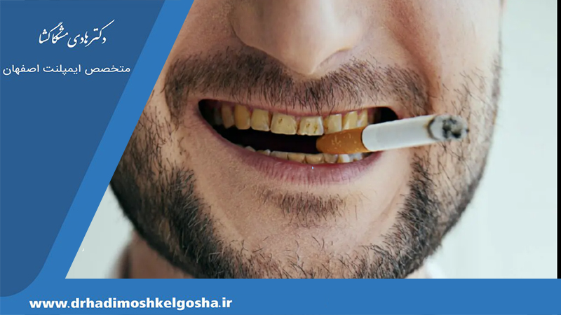 اثرات سیگار بر رنگ دندان ها