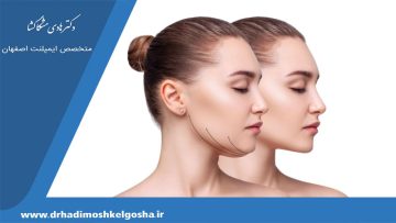 جراحی زیبایی فک برای متقارن سازی چهره