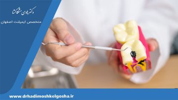 مهم‌ترین علائم پوسیدگی ریشه دندان