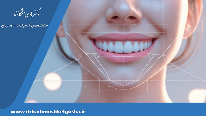 تاثیر فک بر زیبایی لبخند