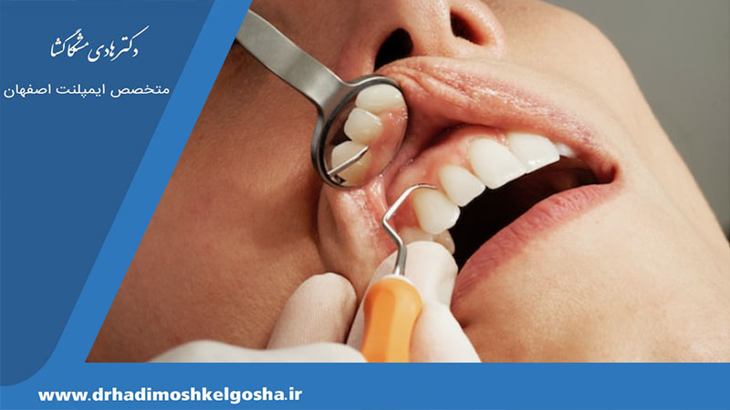 علائم عفونت بعد از جراحی فک