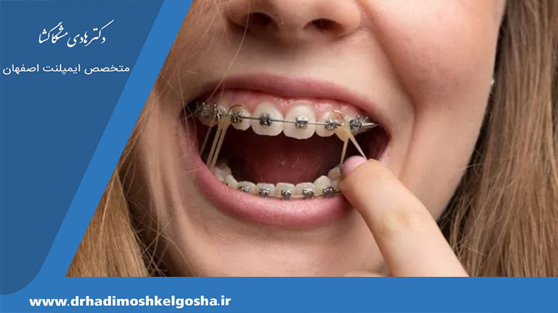 ارتودنسی و درمان اختلال مفصل گیجگاهی فکی