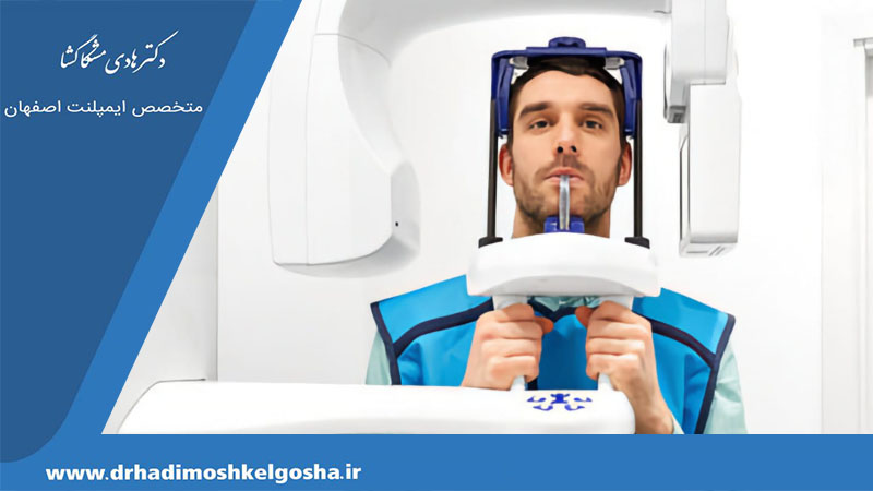 رادیوگرافی پانورامیک و کاربرد آن در تشخیص عارضه فکی