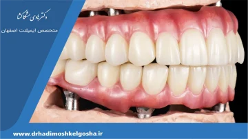 تومورهای فک و صورت