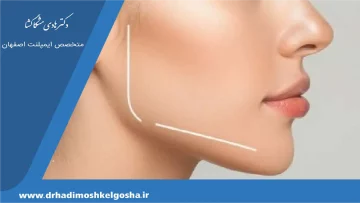 جراحی فک جلو آمده