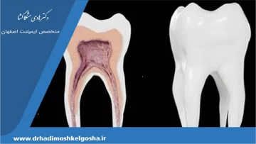 ضرر احتمالی پر کردن دندان